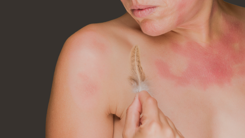 Why Your Sensitive Skin Might Actually Be Damaged Skin