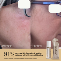 Radiance System