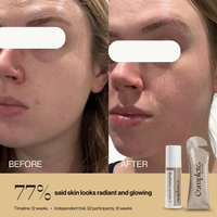 Radiance System