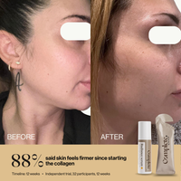 Radiance System