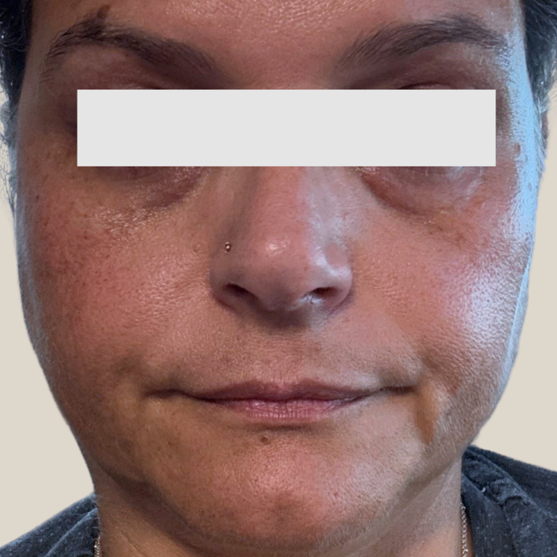 Clarify — Before