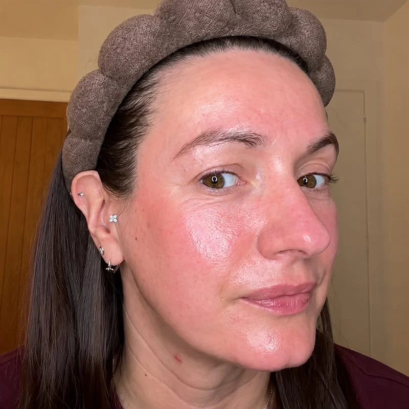 Supports your own collagen formation