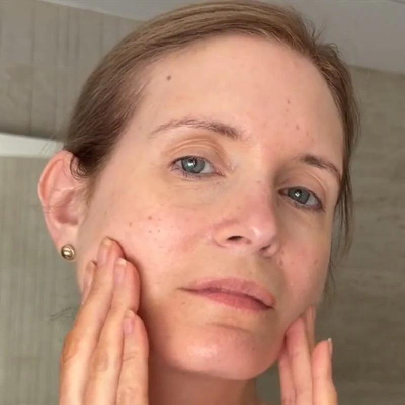 Supports the maintenance of normal skin