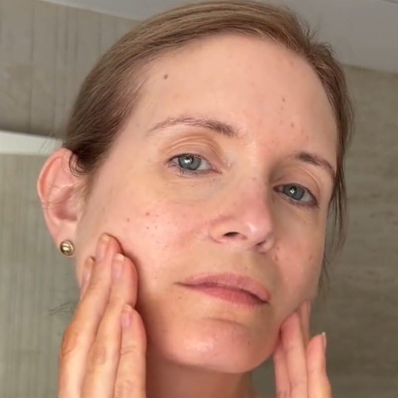 Fine Lines & Wrinkles